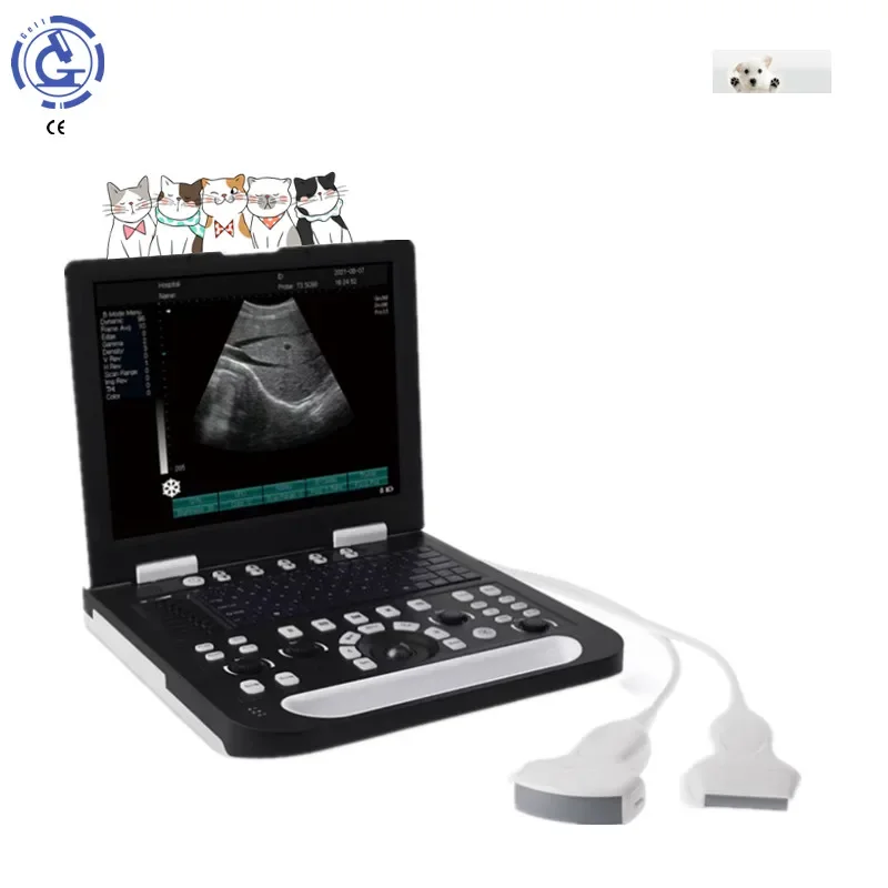 3D portable ultrasonic machine echograph color images LCD screen Obstetrics ultrasound system