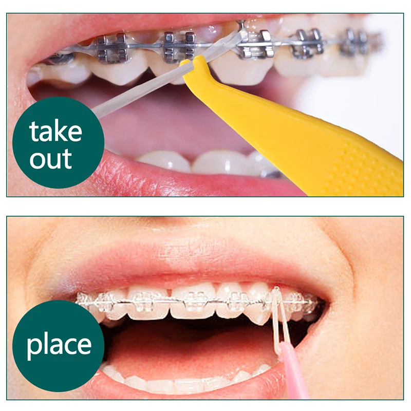 Placer élastiques orthodontiques dentaires pour accolades, bandes de caoutchouc, crochet de placement, placeurs d'anneaux LigMobaught, accessoires de dentisterie, 10 pièces