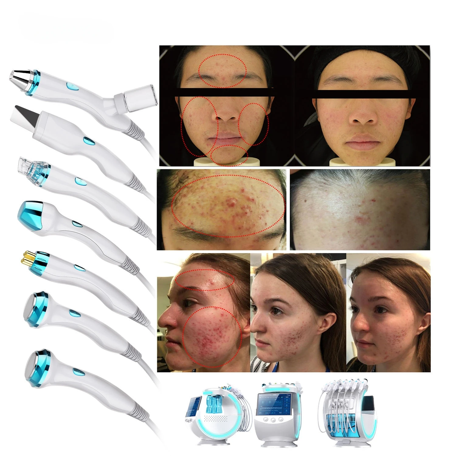 

Beauty Equipment Hydra Skin Analyzer Care Tools Scrubber Vibration Microdermabrasion Skin Analysis Facial Machine