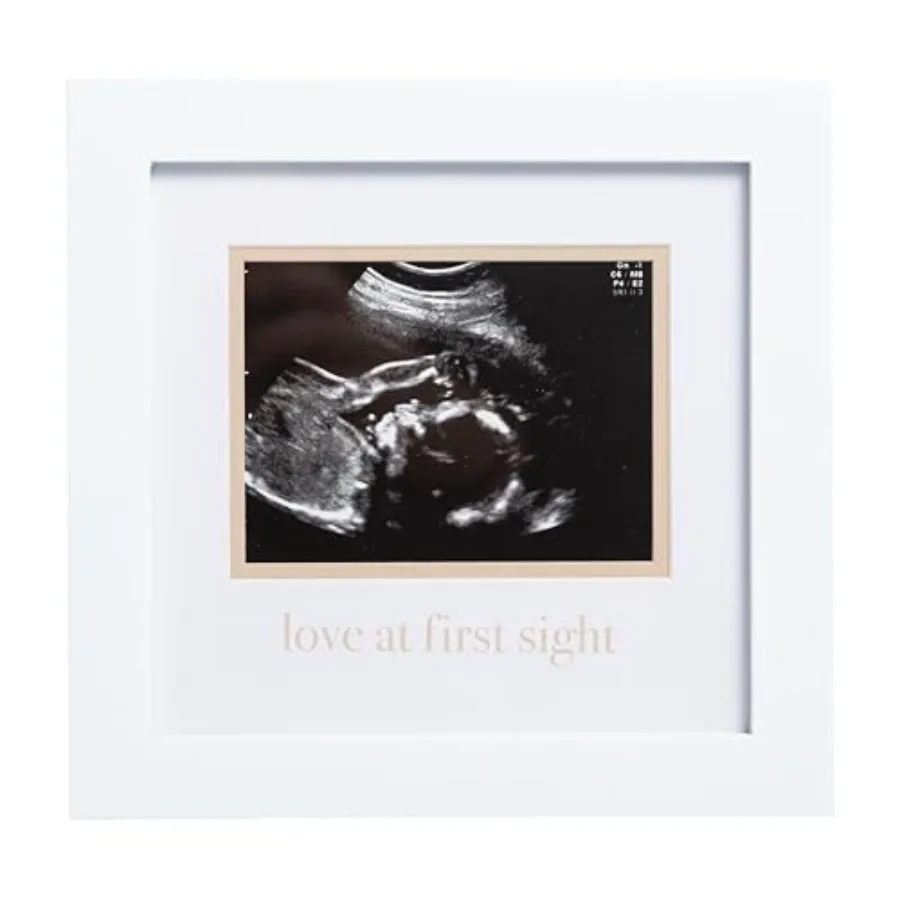 Sonogram Frame, Ultrasound Picture Frame, Pregnancy Announcement Photo Frame, Baby Keepsake Gift For Expecting Parents