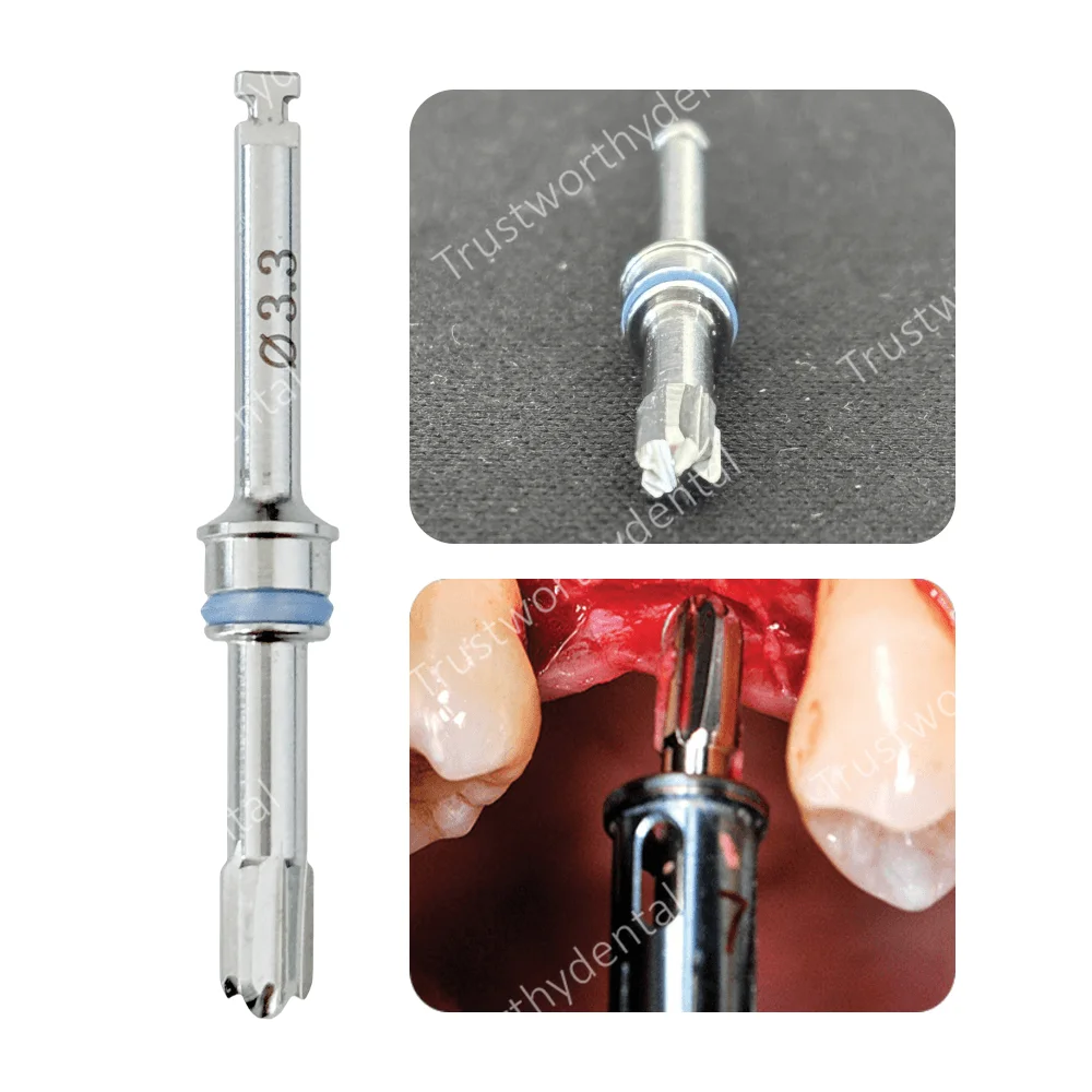 Φ3.3 Dental SD Reamers Drill Crestal Approach Perforate Sinus Wall Membrane Lifting Lifeter Burs Round Head Reamer