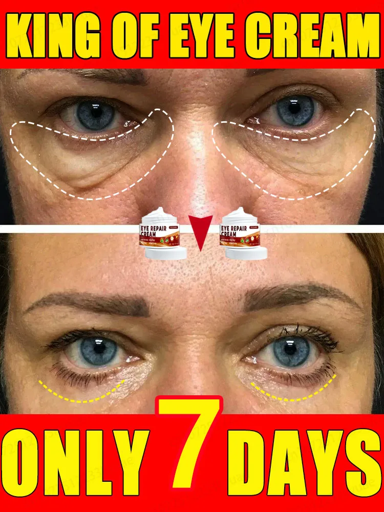 Crema para eliminar bolsas de los ojos con un 99,9% de eficacia, que contiene extractos de Centella Asiática y Aloe Vera, puede mejorar el área de los ojos.