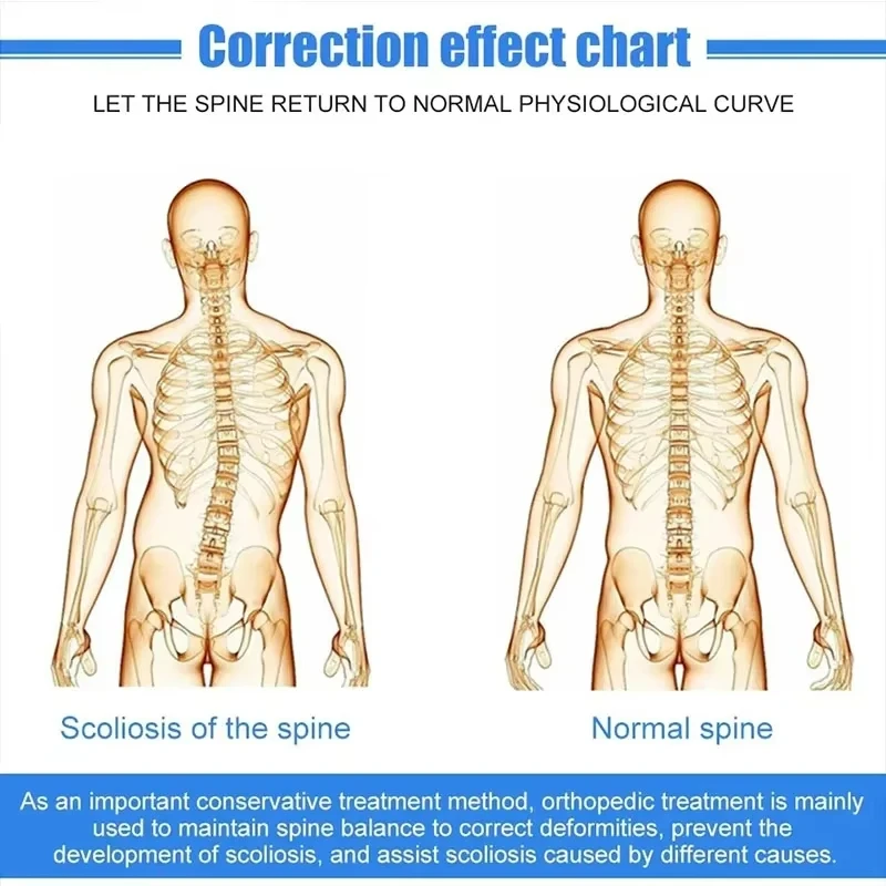 Scoliosis Brace Posture Corrector Treatment Adjustable Spinal Auxiliary Orthosis for Back Postoperative Recovery-For General