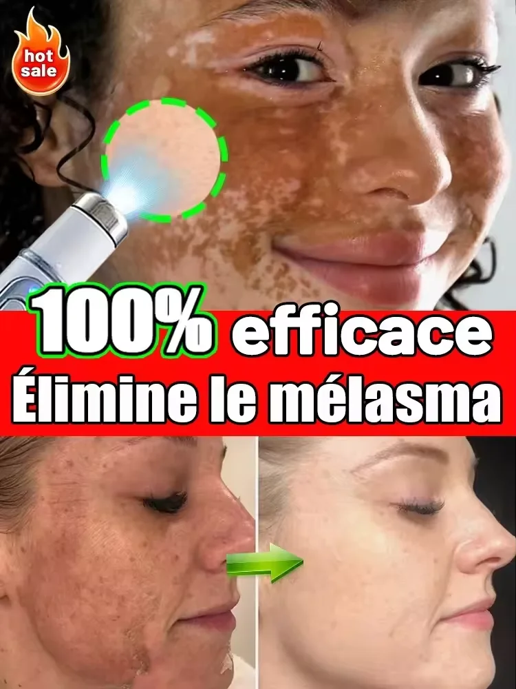 Fading spots Highly effective facial spot removal; fades freckles, melasma, and sunspots.