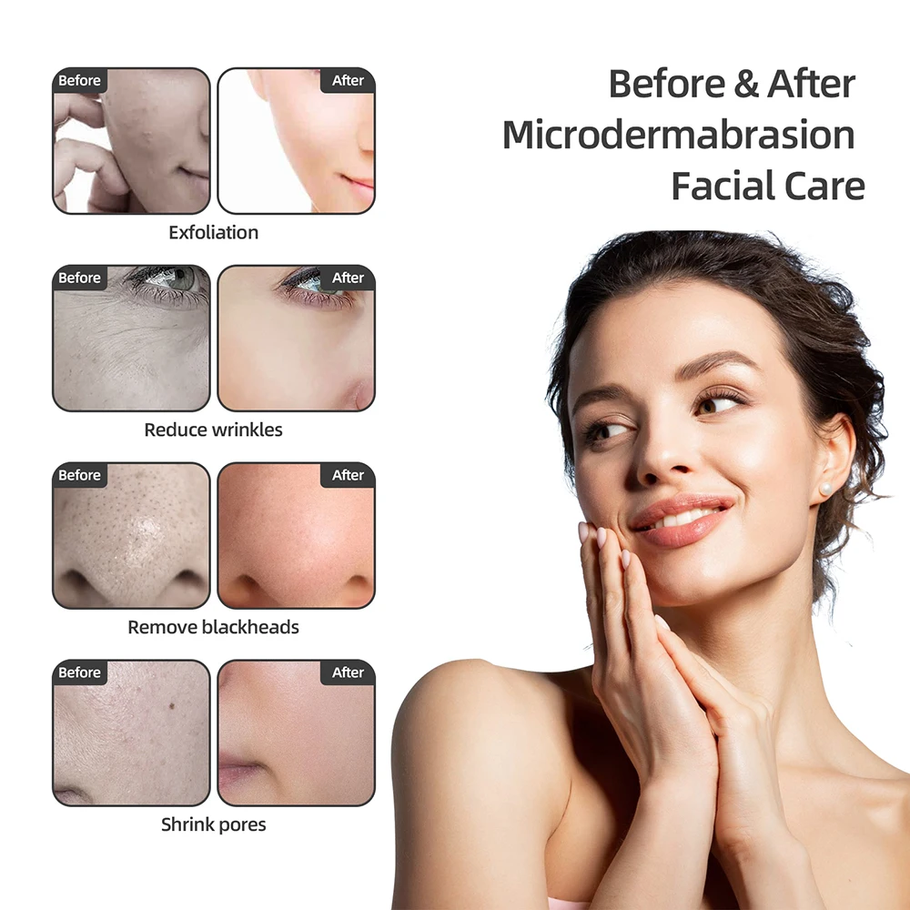 Professional Diamond Microdermabrasion Machine Facial Skin Care Water Spray Exfoliation  Blackhead Removal Beauty Machine