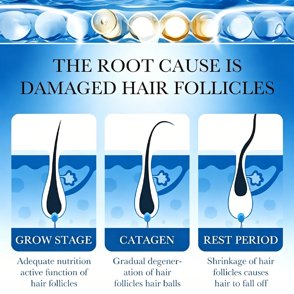 3-Head Rollerball Applicator,New Upgraded Formula,effectively Caring,Suitable For individual use,