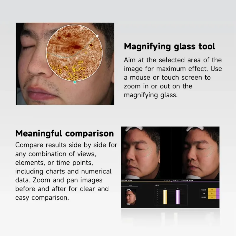 Urządzenie do analizy skóry twarzy, wykrywające przebarwienia, trądzik i potencjalne problemy skóry, do diagnostyki twarzy.