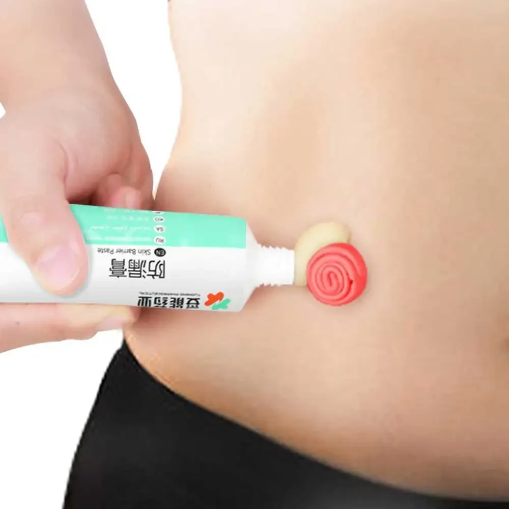 Wholesale Skin Care Powder Stoma Accessories After Surgery Cream Tool Barrier Paste Leak-proof for Ostomy Bag Anti Ointment