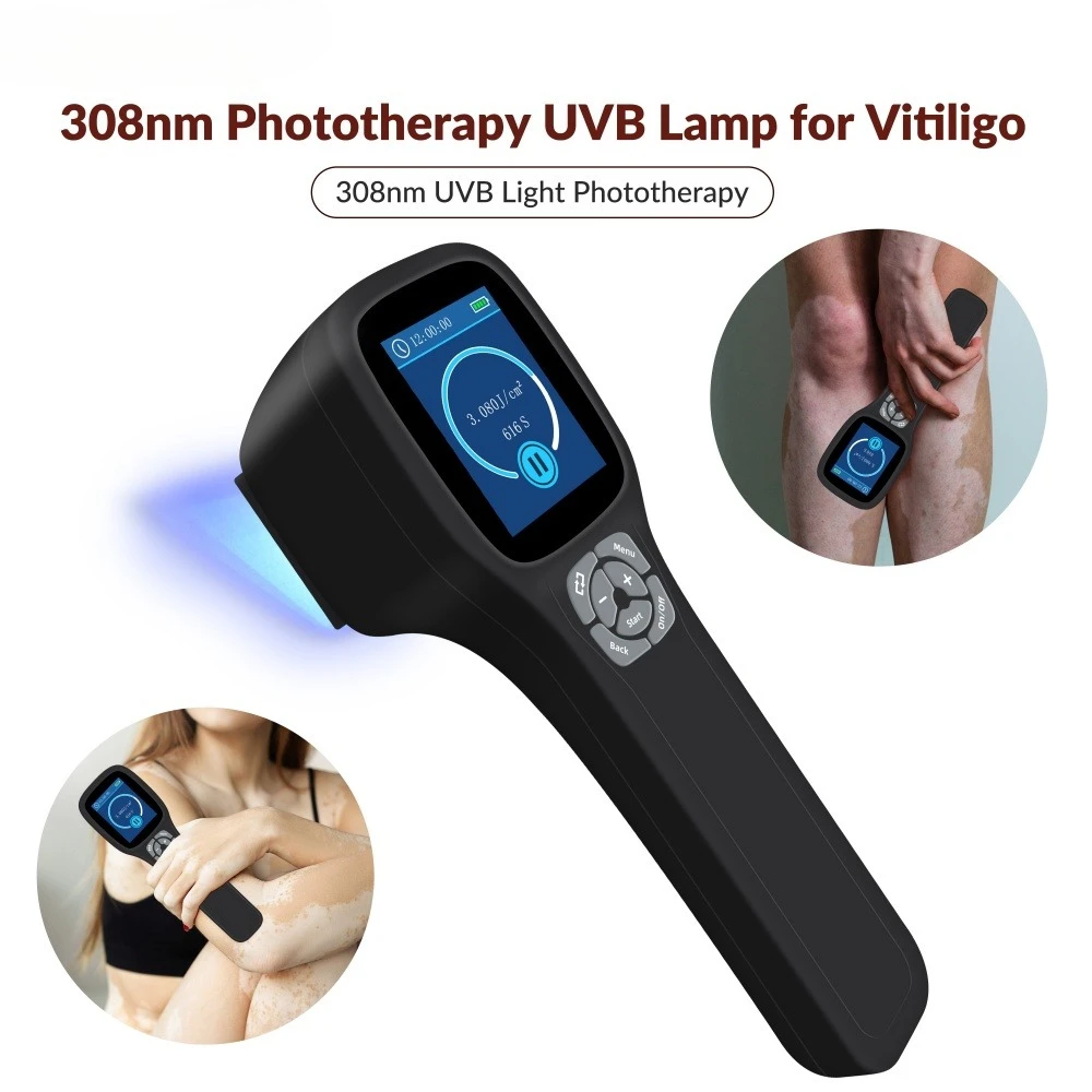 

Frovab Профессиональное устройство для ультрафиолетовой терапии для витилиго, псориаза, экземы, 308 нм, UVB, высокоэффективная лампа для фототерапии