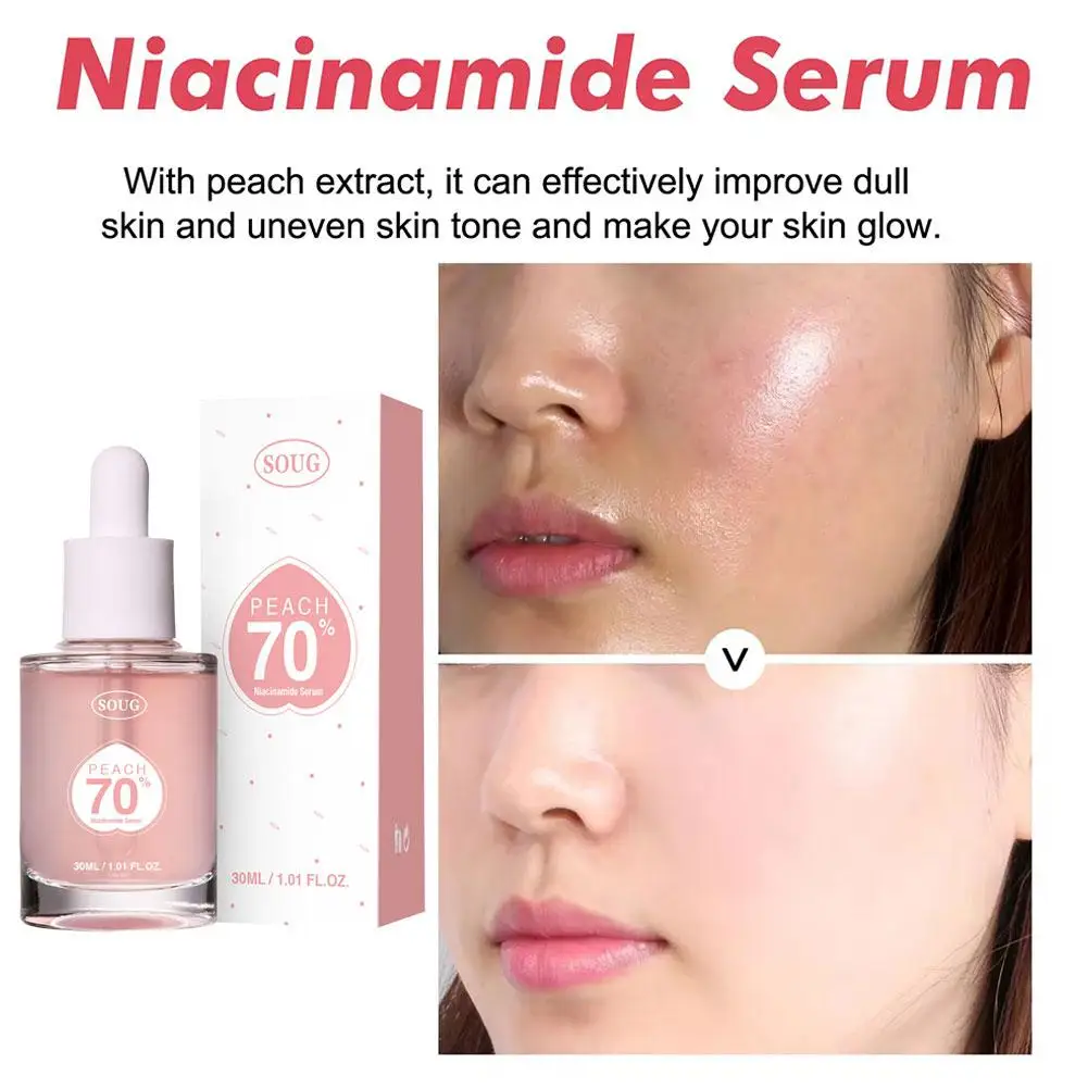 Niacinamide Brightening Hydrating Hyperpigmentation Serum, Clean Face Skin Treatment, Beauty Care Daily, Peach 70%, 30ml, S8J4