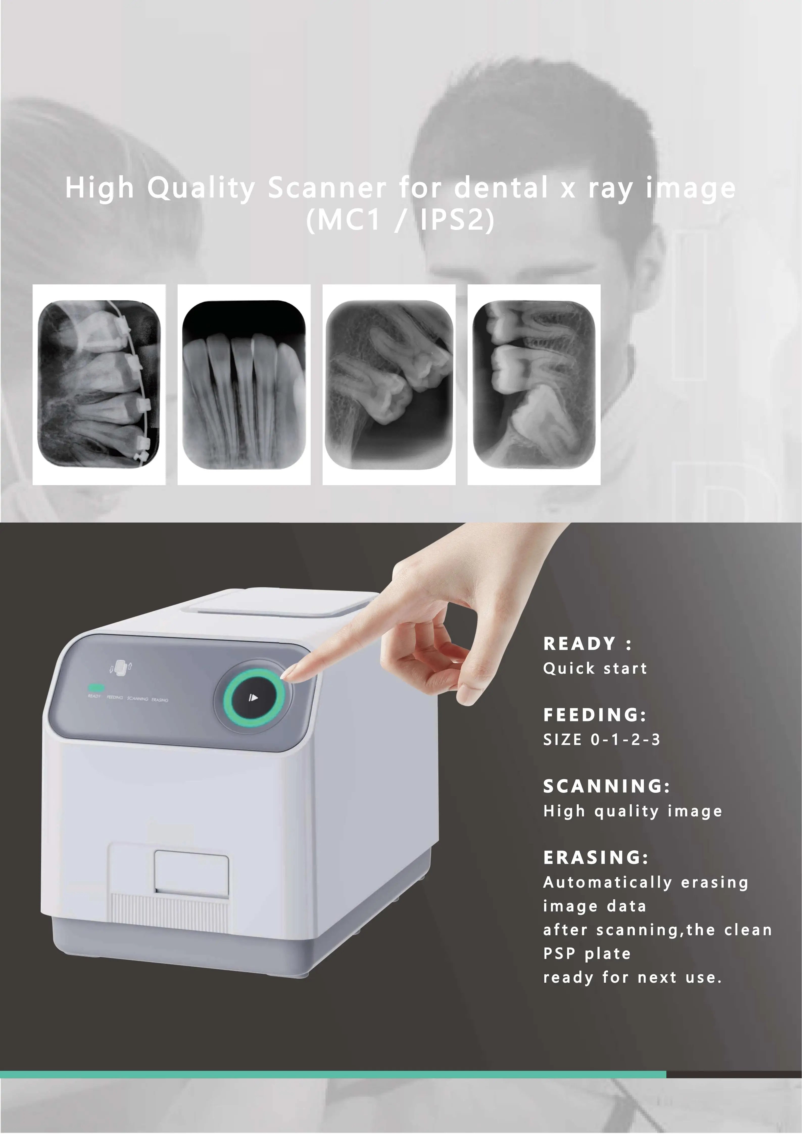 وافق CE ISO عالي الدقة 17lp/mm ماسح لوحة صورة PSP للأشعة السينية للأسنان #6