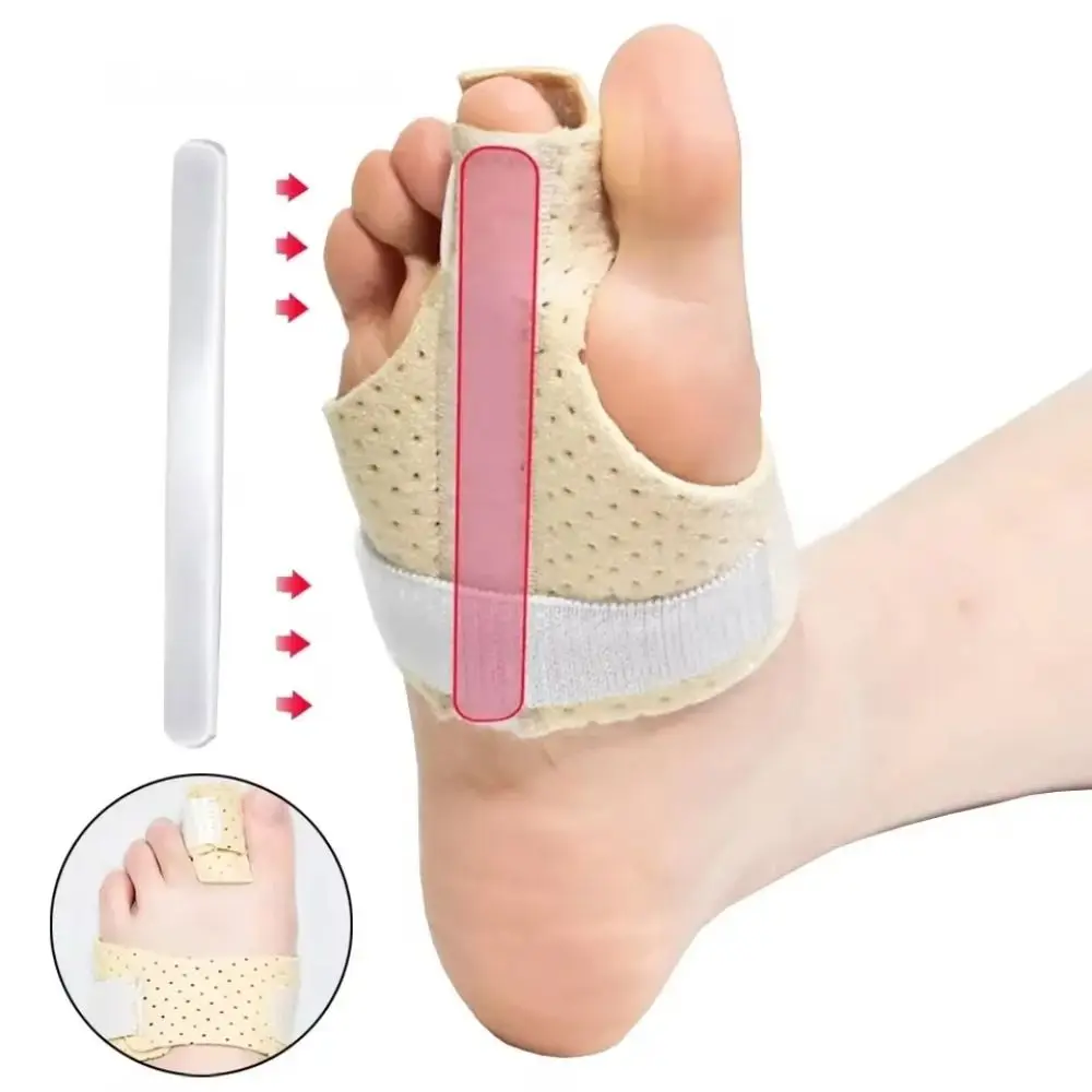 Banda correctora de juanete ajustable, refuerzo de Metal, alisador de dedo gordo transpirable, soporte de articulación Valgus