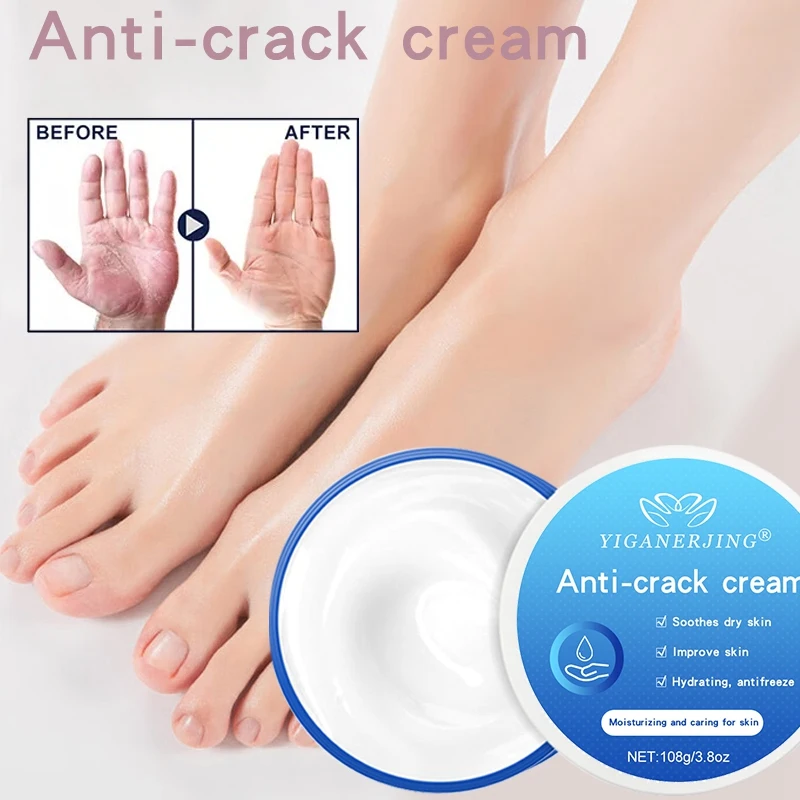 3Pcs YIGANERJING Repair Hand Cream Anti-drying Heel Cracked Repair Crack Foot Cream Removal Dead Skin Hand Feet Care 108G