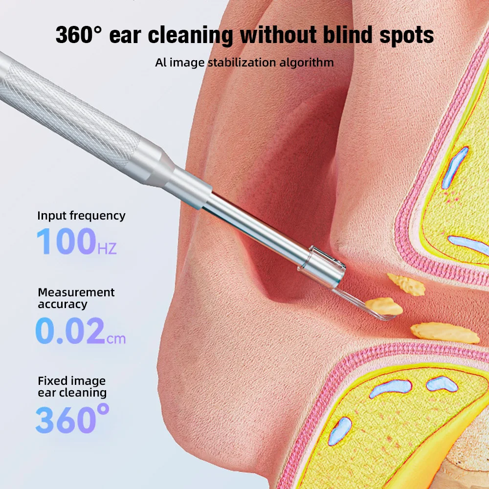 KERUI 3.9mm 귀 내시경 카메라 (6개 조명 포함) 4.3인치 화면 귀지 제거 도구 (어린이 및 성인용) P60