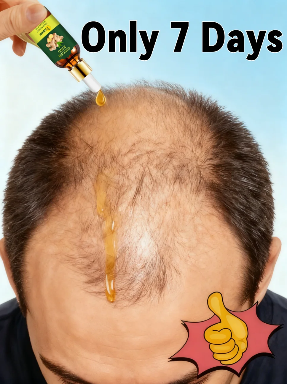 

Сыворотка для роста волос, масляная комбинация, аппликатор для кожи головы, жидкая расческа для лечения кожи головы, устройство для сторонних волос