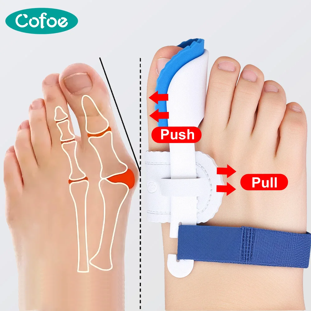 

Cofoe 1 пара, корректор для ног, ортопедические профессиональные инструменты, корректор большого пальца, разделитель для большого пальца ноги, ночной ежедневный уход