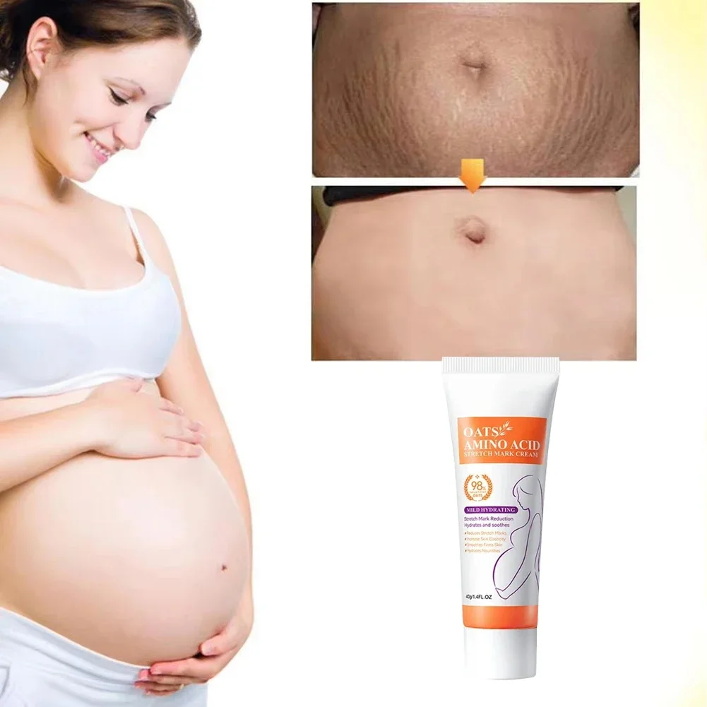 

Pregnancy Repair Stretch Mark Removal Acne Scar Maternity Stretch Marks Remove Fat Striae Scars Treatment skin Care