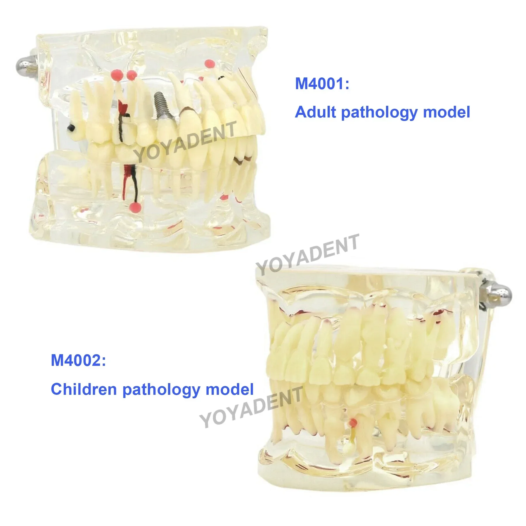 Multiple Types Dental Teeth Model Teaching Models Typodont Orthodontic Model For Studying Dentistry Products Demo