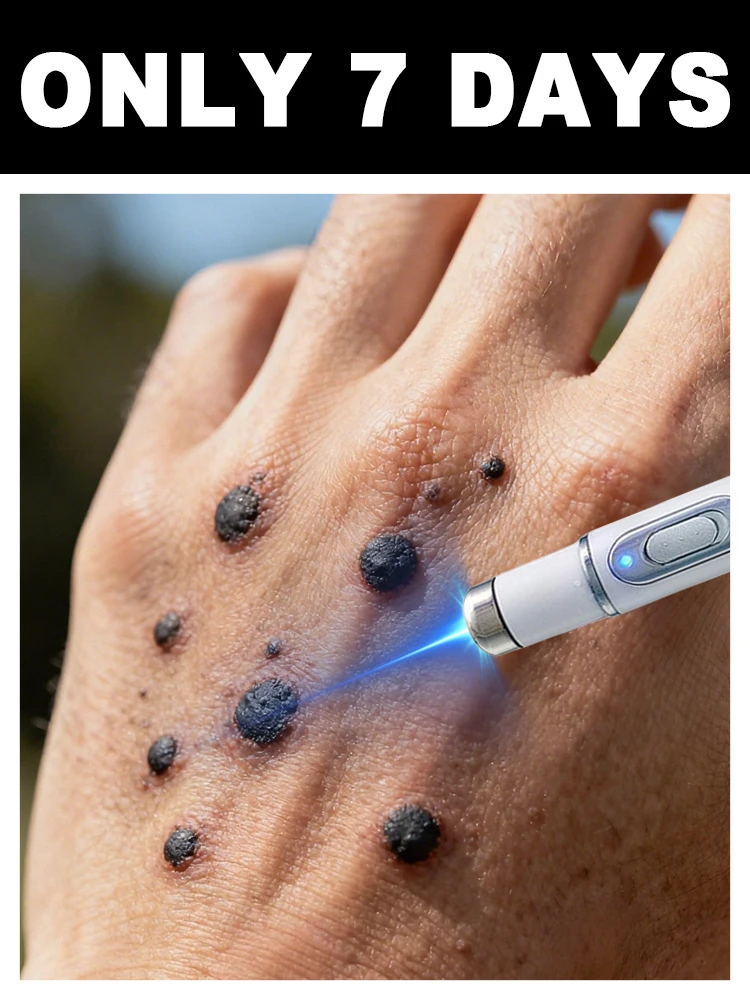 

Réduire le risque d'infection et d'écoulement ᵈᵉ ᵖᵘˢ ᵃᵖʳᵉ̀ˢ ˡᵃ ᵈᵉˢᵗʳᵘᶜᵗⁱᵒⁿ ᵈᵉˢ ᵛᵉʳʳᵘᵉˢ