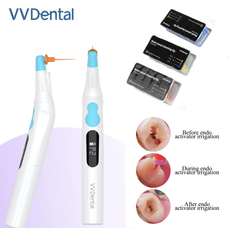 Dental Protable Root Canal Cleaning MachineWith LED Light Sonice Irrigation Activator Dentistry Instrument