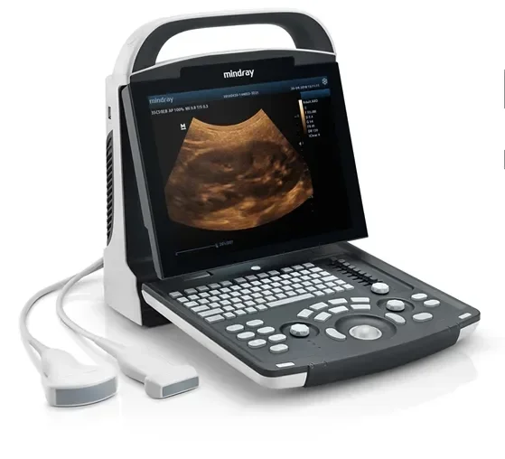 Mindray DP-10 Ultrasound laptop ultrasound Scanner portable ultrasound machine Price