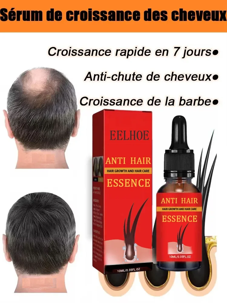 

99% of buyers buy again, have more and more hair, say goodbye to baldness, thick hair,Hot selling product