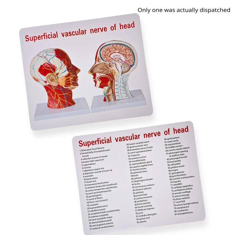

Life-Size Human Anatomy Model Of The Head And Neck, Neurovascular And Muscular Structures, 81 Labeled Parts