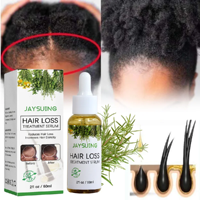 private label Rosemary Hair Growth oil product for black women scalp essential serum organic rose mary treatment for wild bald