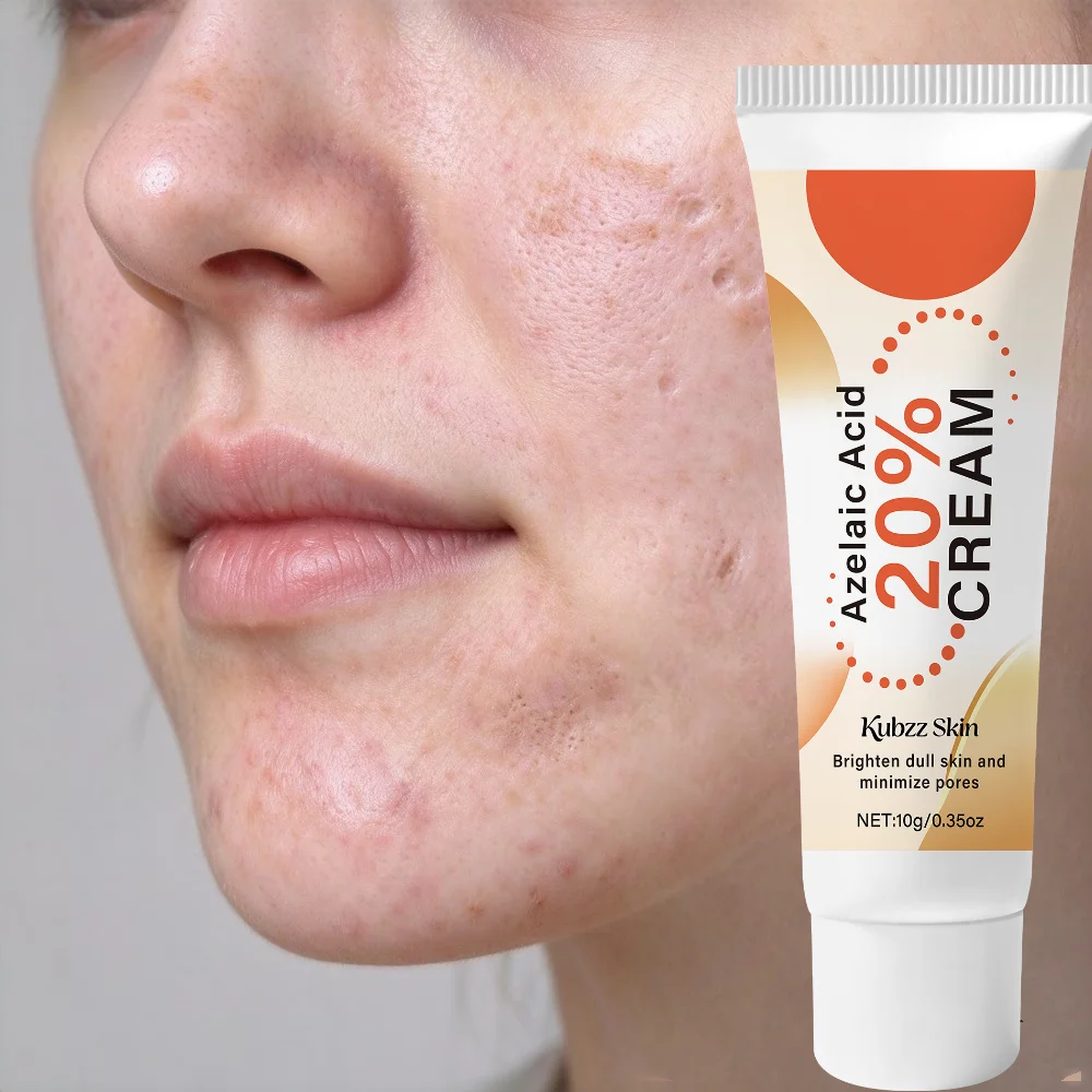 20% Azelaic Acid Cream, Brightening and Pore Care, Soothes and Refines Skin Texture, Suitable for Oily and Sensitive Skin, Facial Moisturizer, Dark Spot Treatment, 10g, Daily Skincare