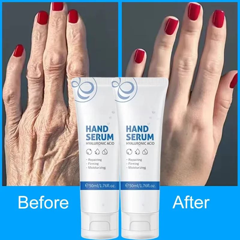 Hyaluronsäure Anti-Falten Hand Serum Creme Haut Erweichen Nähren Anti-Trocknung Bleichen Feuchtigkeitsspendende Rissige Reparatur Produkte Koreanische