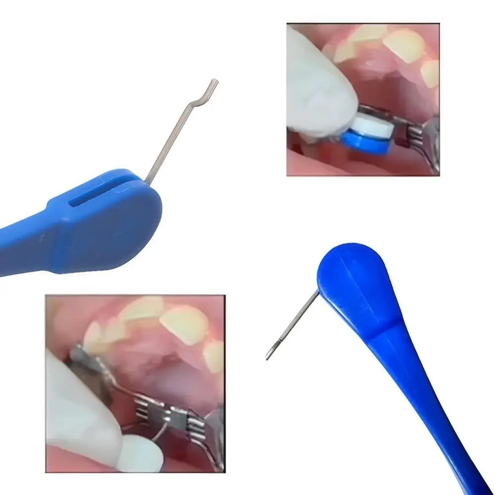  2Pcs Blue Dental Palatal Expander Swivel Key Universal Activation Adjusting Key  Orthodontic Correction Adjustment Dental Tool
