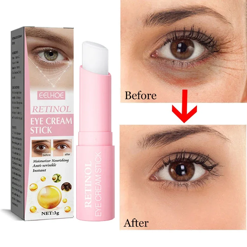 Retinol Eye Cream Instant Removing Eyes Wrinkle Eyes Dark Circles Bags Remover Moisturizing Stick Skin Care Korea Cosmetics ﻿