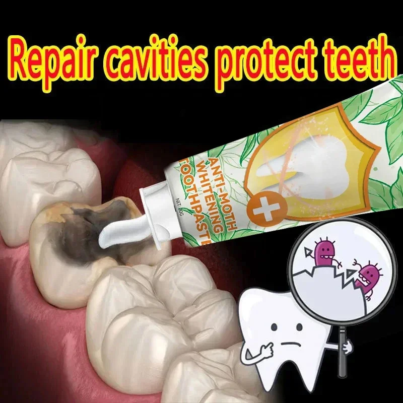 

Anti Decay Toothpaste scientific fluoride repairs cavities, removes cavities, cleans plaque, whitens teeth, and freshens breath