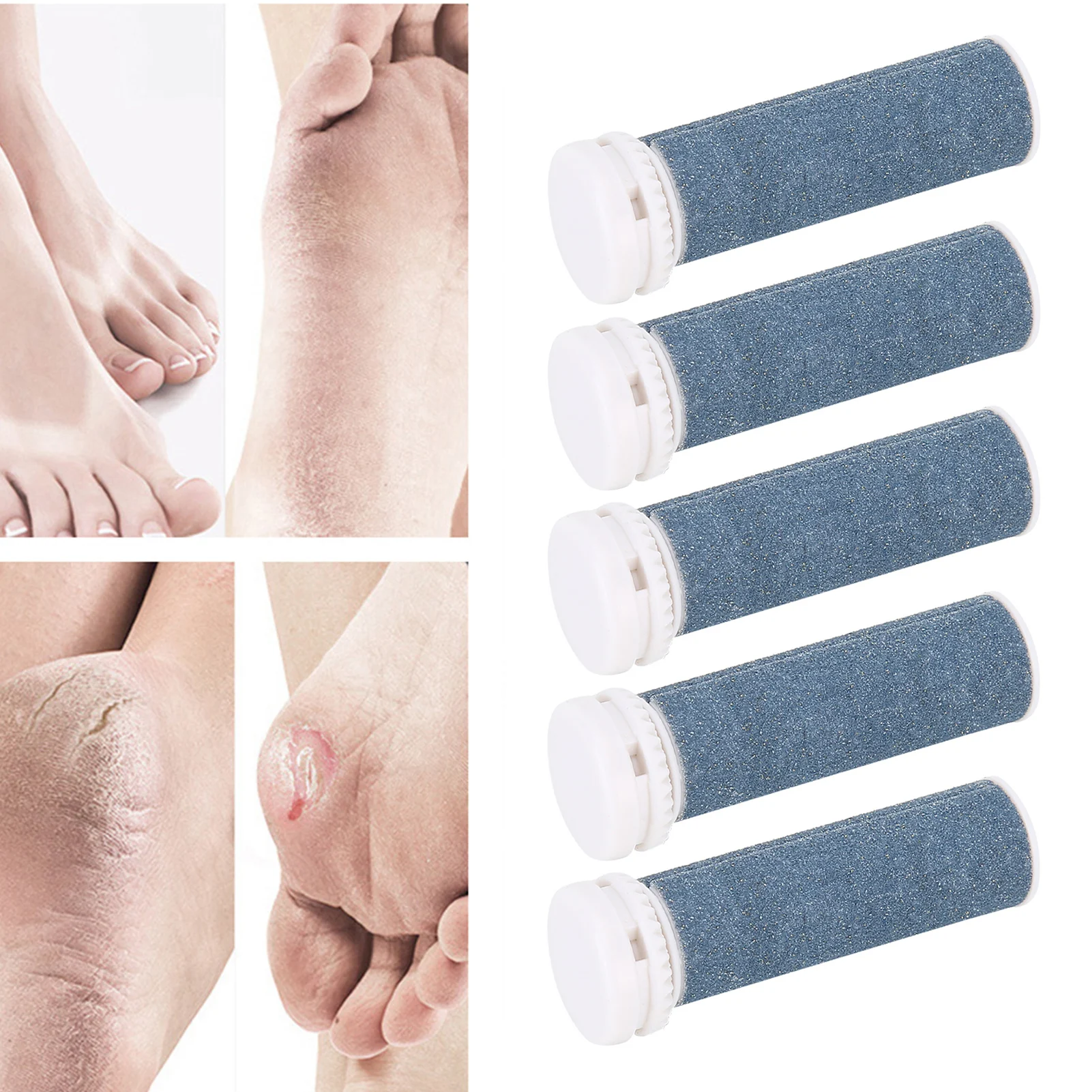 거친 교체 롤러, 하드 스킨 리무버, 풋 케어 페디큐어 리필 롤러, 엑스트라 거친 교체 롤러, 5 개