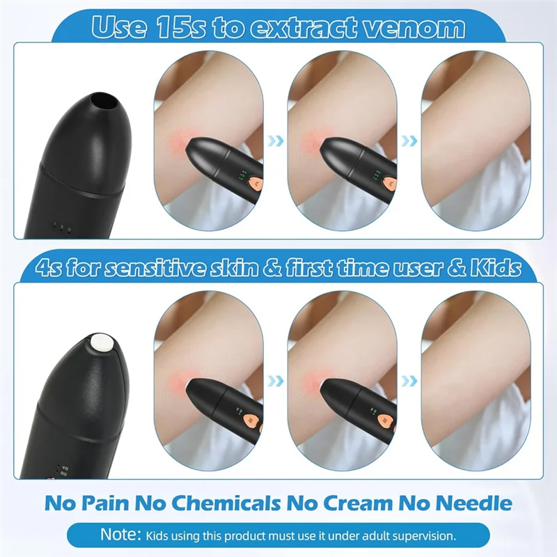 ABUS-Bug لدغة حكة الإغاثة علة لدغة الإغاثة مع أداة شفط الصيف في الهواء الطلق أداة سريعة الحكة الإغاثة من علة ودغات البعوض