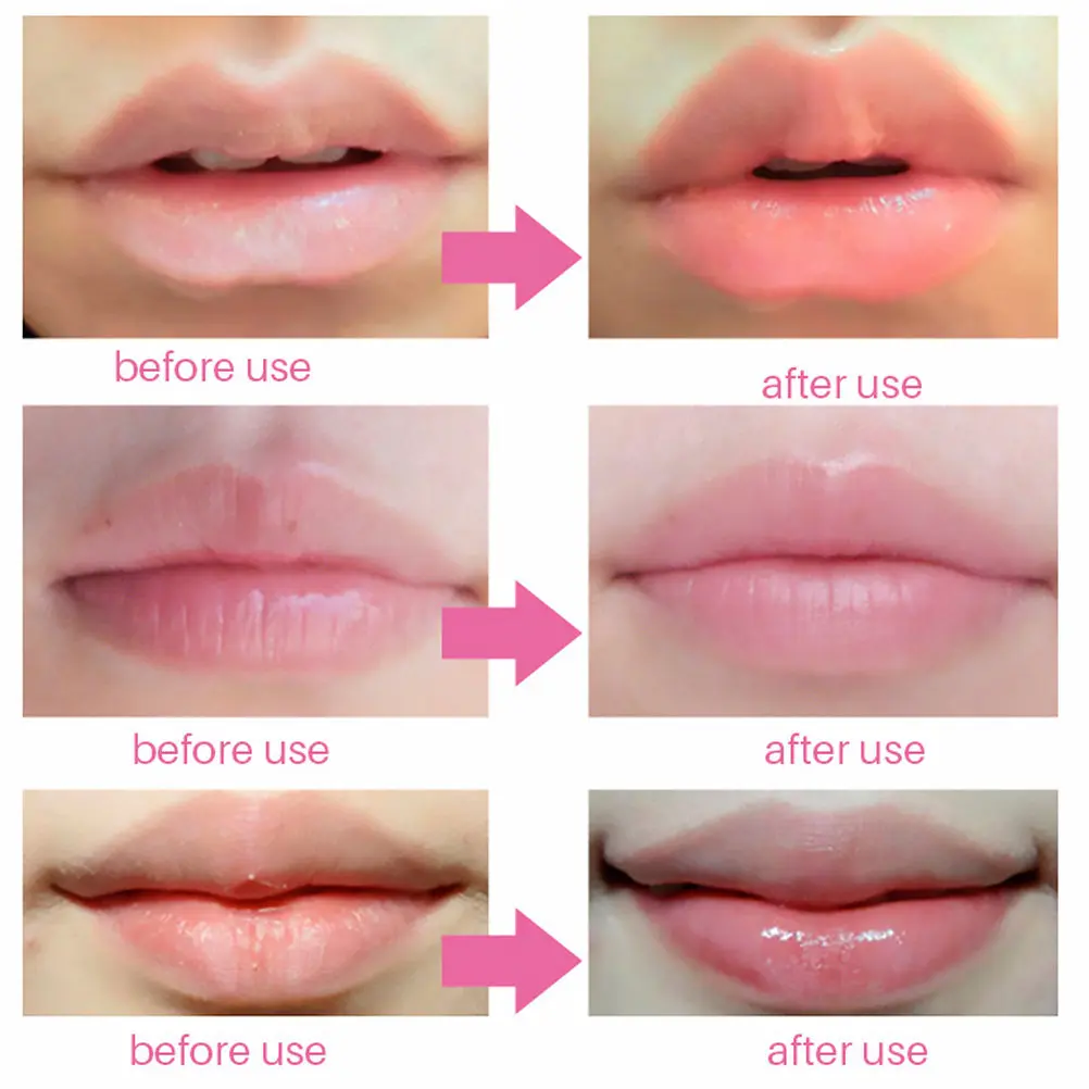 

20 шт. увлажняющих коллагеновых гелевых масок для губ, патчи для увеличения объема губ, питательные косметические средства, бальзам для губ