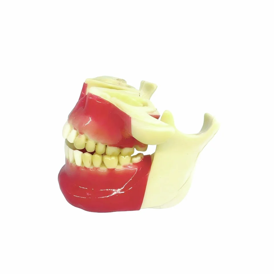 Human Jaw Anatomical Model Life Size Upper Lower Jaw Teeth Replica for Medical Education Dental Training Demonstrations