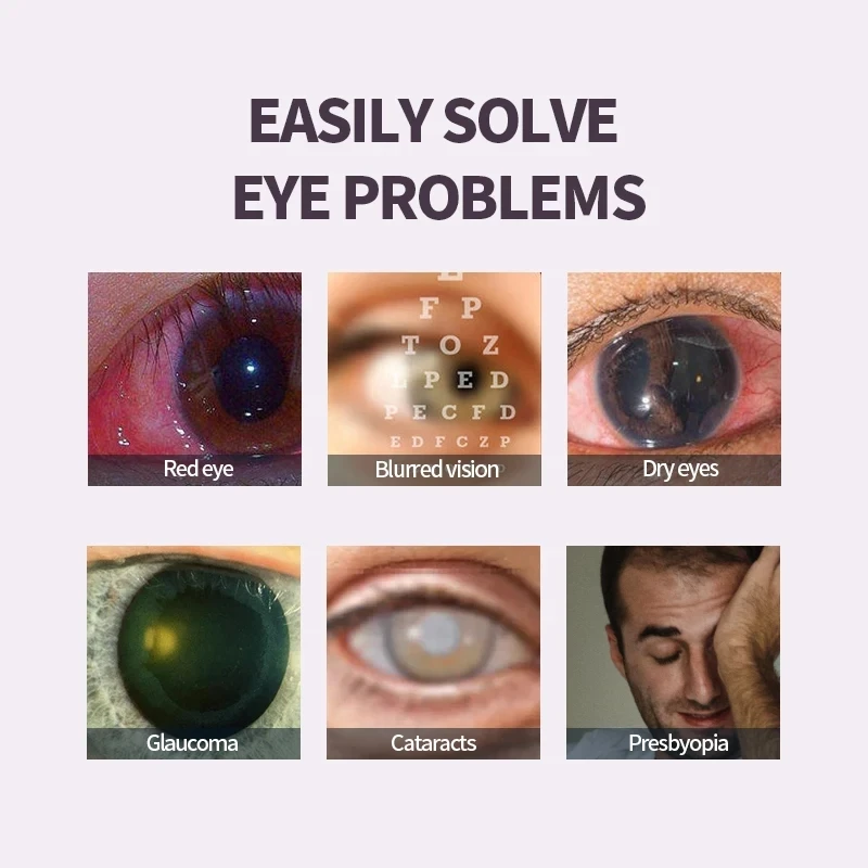 13g/pcs Eye Drops for the Treatment of Cataracts, Glaucoma, Visual Impairment, Relief of Blurred Vision, Eye Care, and Eye Drops