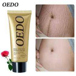 Rose Removes Stretch Mark Cream To Remove Postpartum Obesity Pregnant Women Repair Anti-Aging Anti-Winkles Firming Body Cream