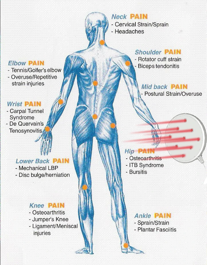 Effective Pain Relief Laser Device Reduce Swelling Stiffness Sports Injuries Home Use Gift