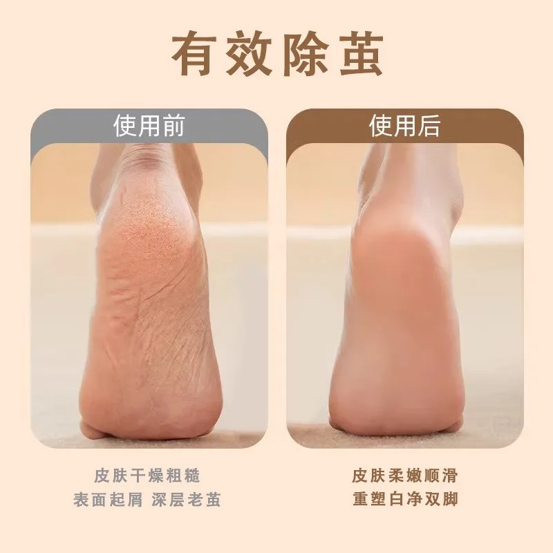 Nail Tools Foot File Removal Pedicure Machine  Foot Callus Remover for Feet