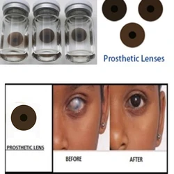 Lentilles de contact prothétiques artificielles pour les yeux, lentilles à iris pour les personnes souffrant de défauts oculaires, glaucome, 1 paire