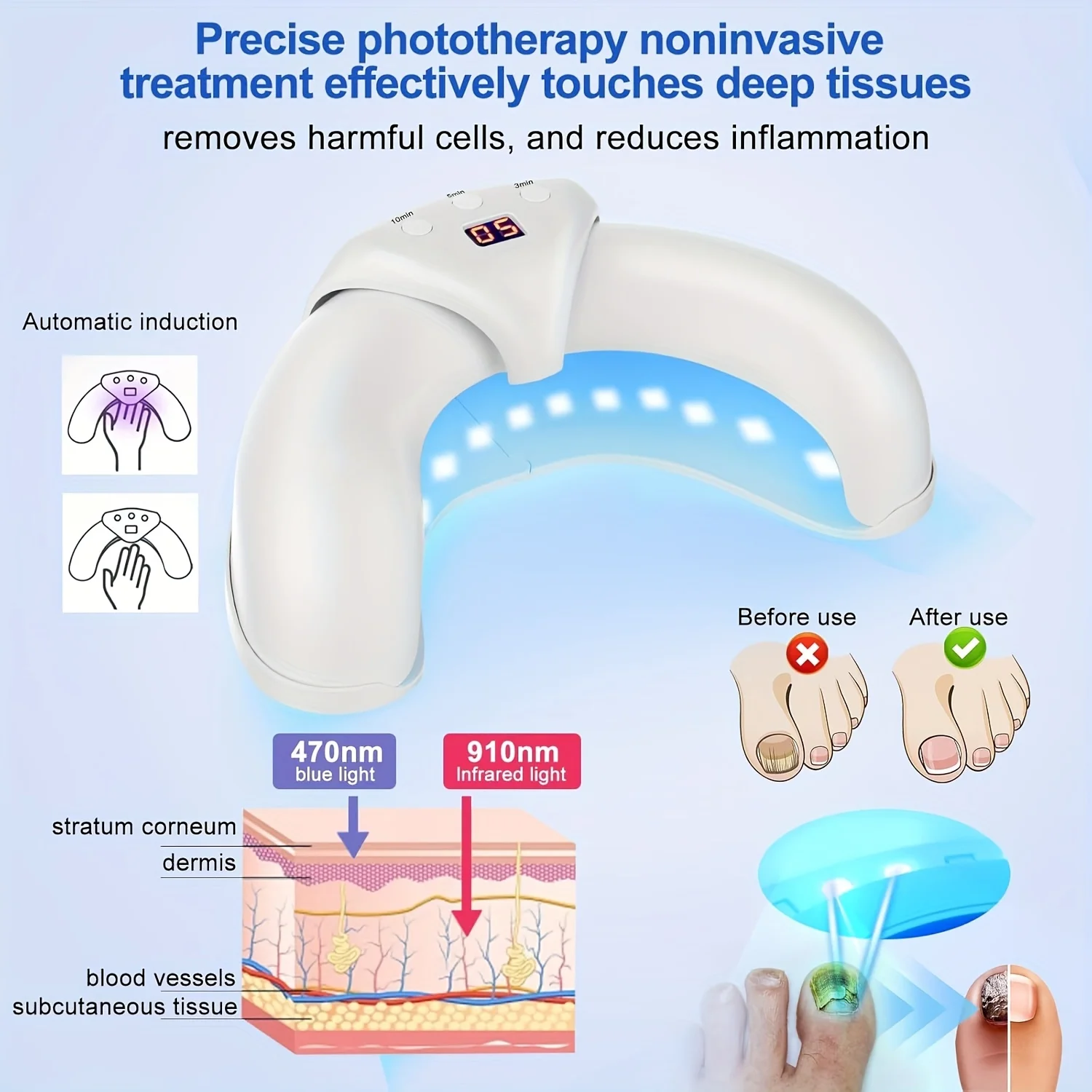 여러 손톱 및 발톱을 위한 1/2/4개 손톱 곰팡이 조명 장치