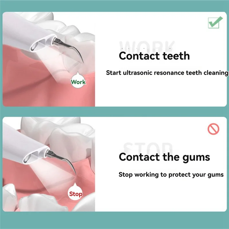 A05G-Ultrasonic Toothbrush Teeth Cleaning And Rinsing For Teeth Tartar Remover Electric A