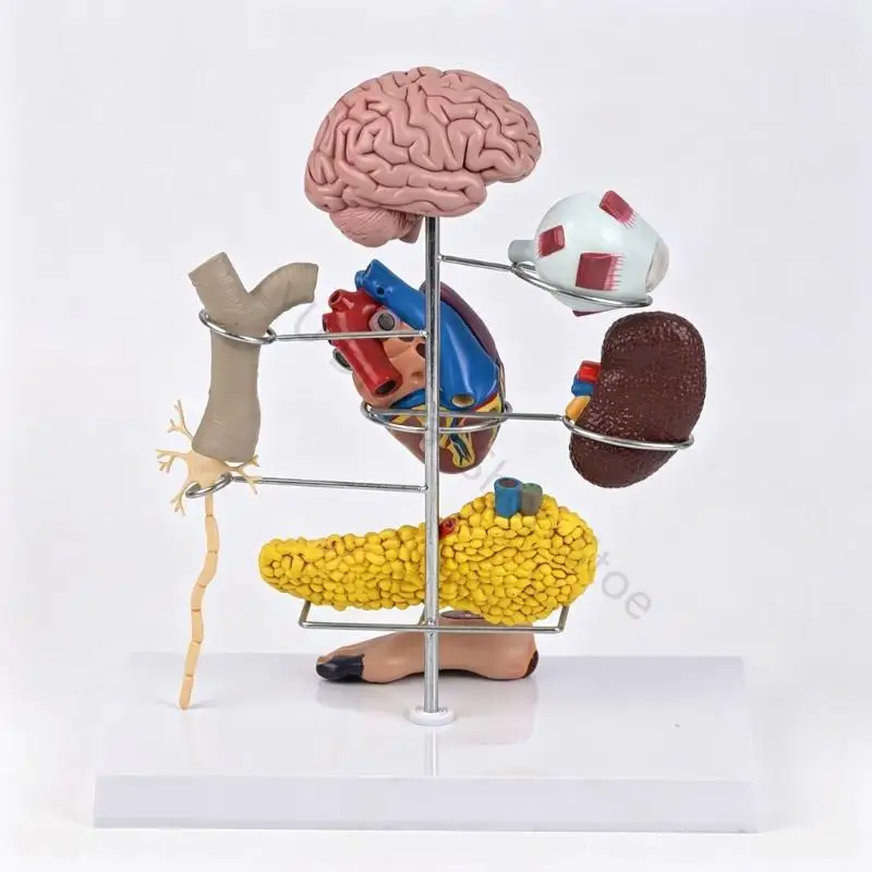 96BA Advanced Diabetes Hypertension Demonstration Model With Accurate Pathological Representations