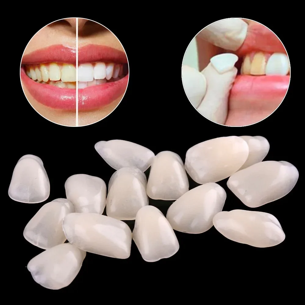 

70pcs Fake Dental Teeth Veneers Ultra Thin Temporary Crown Porcelain Dental Material Oral Care Whitening Resin Anterior Upper