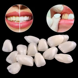 70pcs Fake Dental Teeth Veneers Ultra Thin Temporary Crown Porcelain Dental Material Oral Care Whitening Resin Anterior Upper