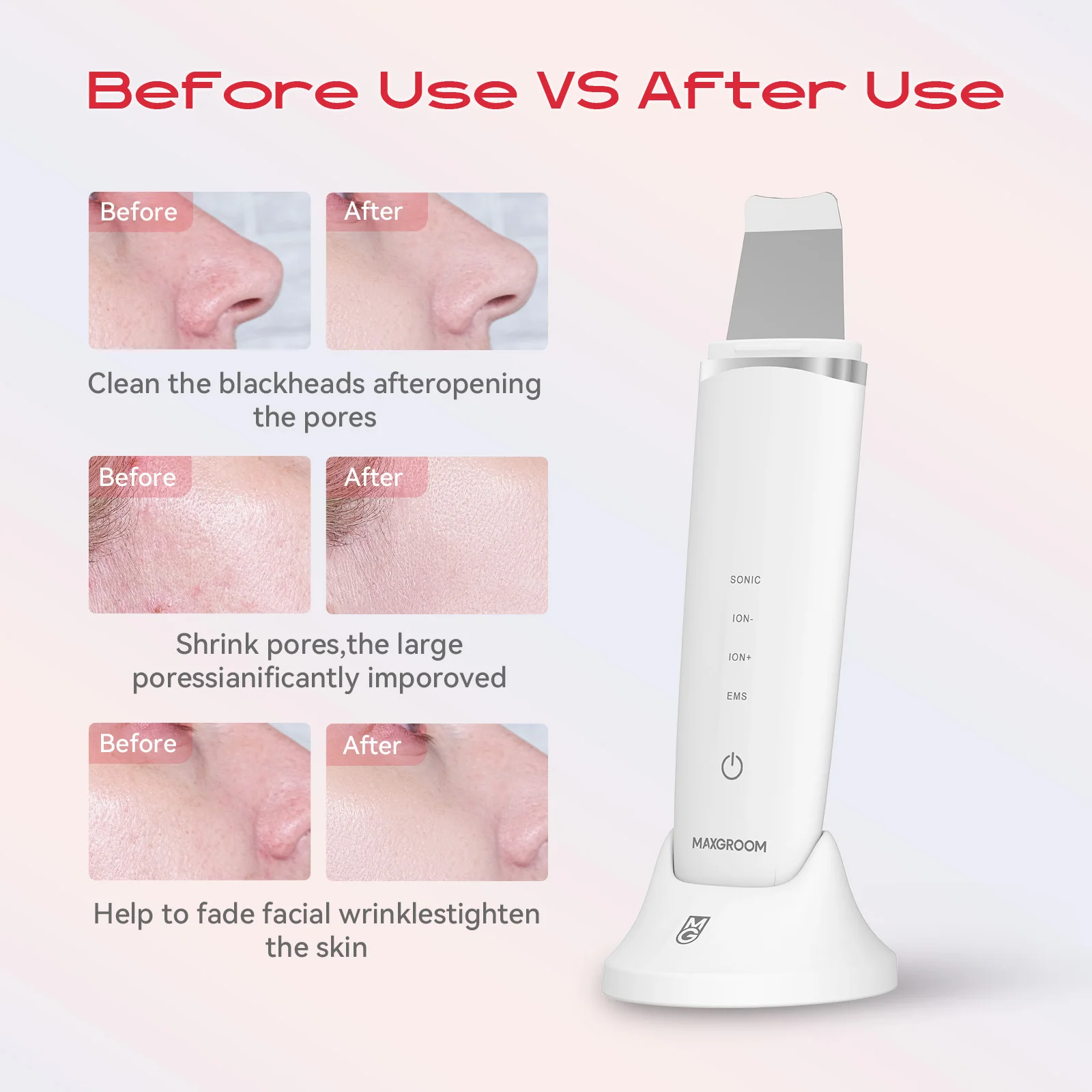 MAXGROOM بالموجات فوق الصوتية الجلد الغسيل تقشير الوجه بالموجات فوق الصوتية EMS شد الوجه الأحمر الأزرق العناية بالبشرة المسام آلة التطهير العميق #6