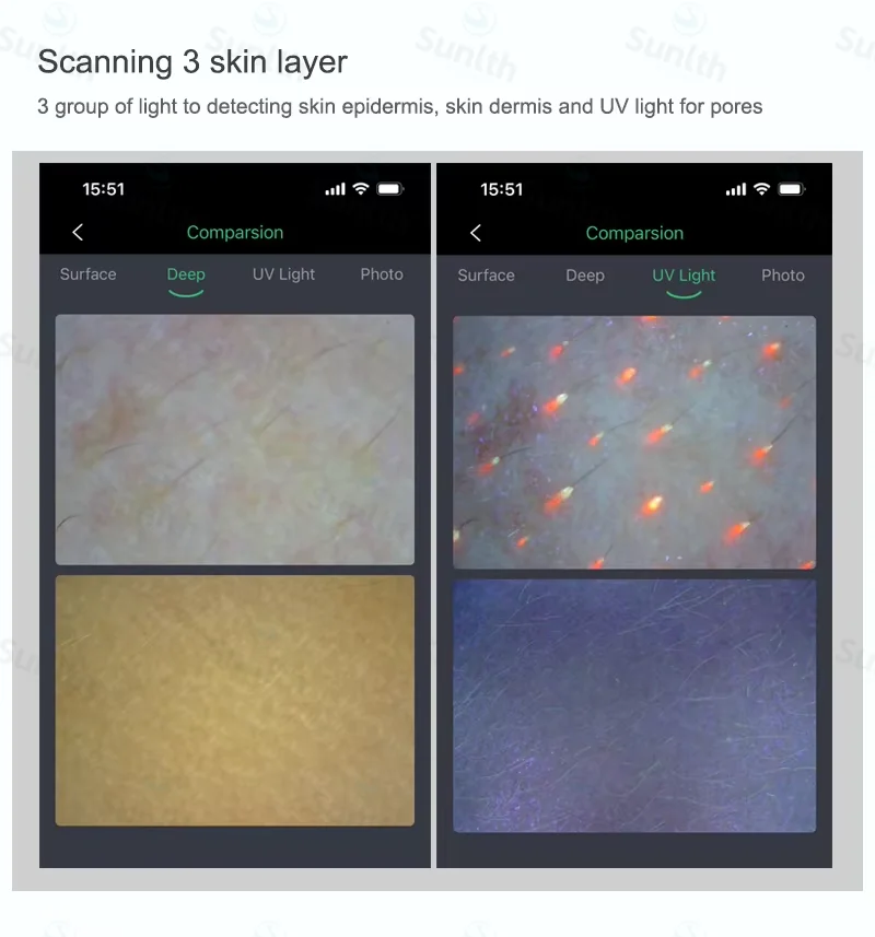 電話とタブレットの使用 Wifi 接続 頭皮/皮膚/毛包検出器 スキンアナライザー 充電式 UV テスト分析拡大鏡