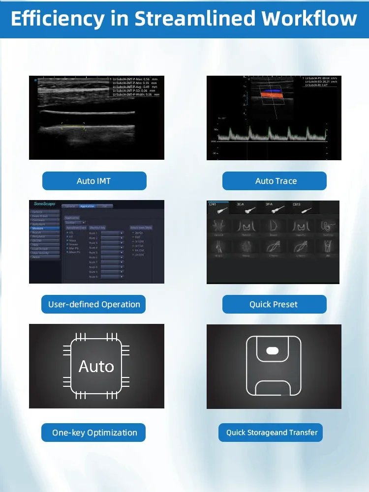 Advanced Sonosite Ultrasound Machine High-Quality White Ultrasound Scanner at Competitive Price